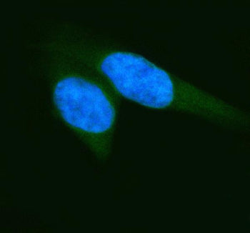 IF analysis of ELP2 using anti-ELP2 antibody (green). ELP2 was detected in an immunocytochemical section of Hela cells. Enzyme antigen retrieval was performed using IHC enzyme antigen retrieval reagent for 15 mins. The cells were blocked with 10% goat serum. And then incubated with 5 ug/ml rabbit anti-ELP2 antibody overnight at 4oC. DyLight 488 Conjugated Goat Anti-Rabbit IgG was used as secondary antibody at 1:500 dilution and incubated for 30 min at 37oC. The section was counterstained with DAPI (blue).