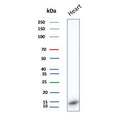 Western blot testing of human heart tissue lysate with FABP3 antibody. Predicted molecular weight ~14 kDa.