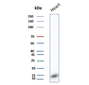 Western blot testing of human heart tissue lysate with FABP3 antibody. Predicted molecular weight ~14 kDa.