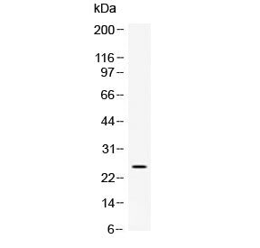 Western blot testing of rat kidney lysate with Vegf antibody at 0.5ug/ml. Expected molecular weight 19~22 kDa (monomer) and 38~44 kDa (dimer). Banding may appear larger than predicted due to glycosylation.