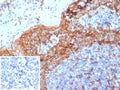 IHC staining of FFPE human tonsil tissue with TMEM173 antibody (clone STING1/7432). Negative control inset: PBS instead of primary antibody to control for secondary binding. HIER: boil tissue sections in pH 9 10mM Tris with 1mM EDTA for 20 min and allow to cool before testing.