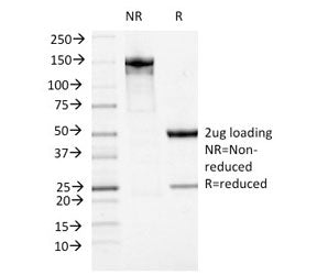 SDS-PAGE analysis of purified, BSA-free ATRX antibody (clone 23c) as confirmation of integrity and purity.