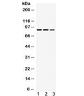 Western blot testing of 1) rat spleen, 2) rat lung, 3) mouse HEPA lysate with MEFV antibody. Expected/observed molecular weight ~86 kDa.