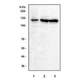 Western blot testing of human 1) A431, 2) K562 and 3) HEL cell lysate with IFNAR1 antibody at 0.5ug/ml. Expected molecular weight: 64-135 kDa depending on glycosylation level.