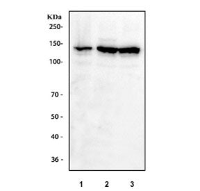 Western blot testing of human 1) A431, 2) K562 and 3) HEL cell lysate with IFNAR1 antibody at 0.5ug/ml. Expected molecular weight: 64-135 kDa depending on glycosylation level.