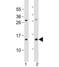 Western blot testing of 1) human HL-60 and 2) mouse Neuro-2a cell lysate with EIF1 antibody at 1:2000. Predicted molecular weight: 13 kDa.
