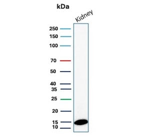 Western blot testing of human kidney tissue lysate with FABP1 antibody (clone FABP1/4518). Predicted molecular weight ~15 kDa.