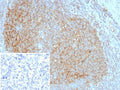 IHC staining of FFPE human tonsil tissue with CD35 antibody (clone CR1/8283R). Inset: PBS used in place of primary Ab (secondary Ab negative control). HIER: boil tissue sections in pH 9 10mM Tris with 1mM EDTA for 20 min and allow to cool before testing.