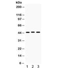 Western blot testing of 1) rat stomach, 2) human HeLa and 3) human PANC lysate with Connexin 45 antibody. Expected/observed molecular weight ~45 kDa.