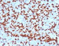 IHC testing of FFPE human tonsil with ZAP70 antibody (clone ZPT70-2). HIER: boil tissue sections in pH 9 10mM Tris with 1mM EDTA for 10-20 min followed by cooling at RT for 20 min.