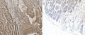 IHC testing of FFPE human heart tissue with NKX2.5 antibody (left) and without NKX2.5 antibody (right). Required HIER: steamed antigen retrieval with pH6 citrate buffer; AP-staining.