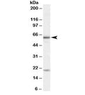 Western blot testing of HeLa cell lysate with BMPR1A antibody at 1ug/ml. Molecular weight: he expected ~60kDa band and additional ~20kDa band are both blocked by the immunizing peptide.