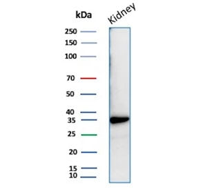 Western blot testing of human kidney tissue lysate with recombinant Napsin A antibody. Expected molecular weight: 38-45 kDa.