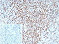 IHC staining of FFPE analysis of human tonsil tissue with Lymphoid enhancer-binding factor 1 antibody (clone LEF1/8629R). Strong nuclear staining of non-germinal center cells observed. Inset: PBS used in place of primary Ab (secondary Ab negative control). HIER: boil tissue sections in pH 9 10mM Tris with 1mM EDTA for 20 min and allow to cool before testing.