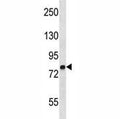 MMP9 antibody western blot analysis in NCI-H292 lysate. Predicted molecular weight: 92/67-80 kDa (precursor/mature forms).