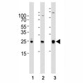 Western blot analysis of lysate from (1) human A431, (2) mouse NIH3T3, (3) rat C6 cell line using RAC1 antibody at 1:1000.