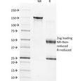 SDS-PAGE analysis of purified, BSA-free TIMP1 antibody (clone 2A5) as confirmation of integrity and purity.