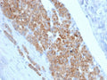 IHC staining of FFPE human adrenal gland with StAR antibody (clone STAR/2140). Required HIER: boil tissue sections in 10mM citrate buffer, pH 6, for 10-20 min followed by cooling at RT for 20 min.