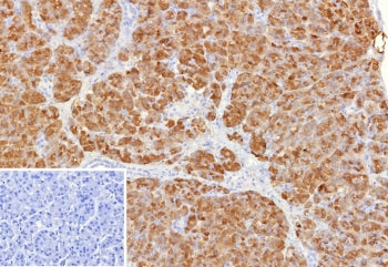 IHC staining of FFPE human pancreas tissue with Colipase antibody (clone CLPS/9901). Inset: PBS used in place of primary Ab (secondary Ab negative control). HIER: boil tissue sections in pH 9 10mM Tris with 1mM EDTA for 20 min and allow to cool before testing.