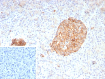 IHC staining of FFPE human pancreas tissue with SYP antibody (clone rSYP/8807). Inset: PBS used in place of primary Ab (secondary Ab negative control). HIER: boil tissue sections in pH 9 10mM Tris with 1mM EDTA for 20 min and allow to cool before testing.