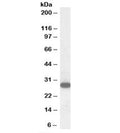 Western blot testing of human peripheral blood mononucleocyte lysate with RGS18 antibody at 1ug/ml. Predicted molecular weight: ~28kDa.