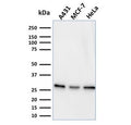 Western blot testing of human samples with Myofibroblast antibody (clone PR 2D3).