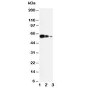 Western blot testing of ADAM10 antibody and Lane 1: recombinant human protein 10ng; 2: 5ng; 3: 2.5ng
