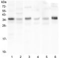 Western blot testing of 1) human HL-60, 2) human U-87 MG, 3) rat liver, 4) rat stomach, 5) mouse spleen and 6) mouse thymus lysate with CD40L antibody at 0.5ug/ml. Expected molecular weight: 29-39 kDa (depending on glycosylation level) or ~18 kDa (soluble form).