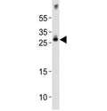 Western blot analysis of lysate from mouse brain tissue lysate using Olig1 antibody diluted at 1:1000. Predicted size 25~35 kDa
