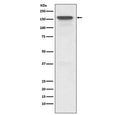Western blot testing of human HeLa cell lysate with MDR1 antibody. Expected molecular weight: 141-180 kDa depending on glycosylation level.