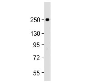 Western blot testing of human U-87 MG cell lysate with SCN1A antibody at 1:2000. Predicted molecular weight ~229 kDa, routinely observed at ~250 kDa.