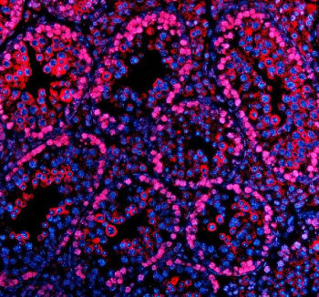 Immunofluorescent staining of PARP11 using anti-PARP11 antibody (red). PARP11 was detected in a paraffin-embedded section of mouse testis tissue. Heat mediated antigen retrieval was performed in EDTA buffer (pH 8.0, epitope retrieval solution). The tissue section was blocked with 10% goat serum. The tissue section was then incubated with 5 ug/ml rabbit anti-PARP11 antibody overnight at 4oC. Cy3 Conjugated Goat Anti-Rabbit IgG was used as secondary antibody at 1:500 dilution and incubated for 30 min at 37oC.
