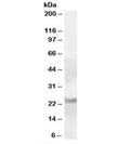 Western blot testing of human cerebellum lysate with RAB8A antibody at 0.1ug/ml. Predicted molecular weight: ~24kDa.
