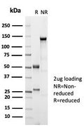 SDS-PAGE analysis of purified, BSA-free recombinant ER beta 1 antibody (clone ESR2/7006R) as confirmation of integrity and purity.