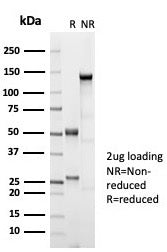 SDS-PAGE analysis of purified, BSA-free recombinant ER beta 1 antibody (clone ESR2/7006R) as confirmation of integrity and purity.