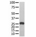 GST Tag antibody used in western blot with recombinant protein