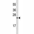 MUC1 antibody western blot analysis in MDA-MB435 lysate. This Ab will detect the 23-29 kDa isoforms of MUC1.