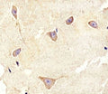 IHC analysis of FFPE human brain section using TrkC antibody; Ab was diluted at 1:100.