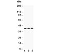 Western blot testing of IL3 antibody and Lane 1: PC-12; 2: NRK; 3: RH35; The glycoprotein is routinely visualized between 18~35 kDa.