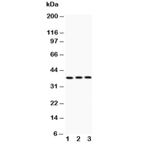 Western blot testing of IL3 antibody and Lane 1: PC-12; 2: NRK; 3: RH35; The glycoprotein is routinely visualized between 18~35 kDa.