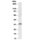 Western blot testing of human bone marrow lysate with TREML1 antibody at 0.5ug/ml. Predicted molecular weight: ~33kDa.