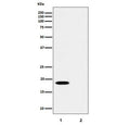 Western blot testing of lysate from 1) human HUVEC and 2) human HUVEC treated with alkaline phosphatase, using phospho-PTS antibody.