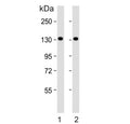Western blot testing of human 1) 293T and 2) Jurkat cell lysate with PFAS antibody. Predicted molecular weight ~145 kDa.