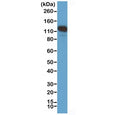 Western blot testing of human A375 cell lysate with recombinant CD146 antibody at 1:1000. Observed molecular weight 70-120 kDa depending on glycosylation level.