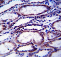 COL1A1 antibody immunohistochemistry analysis in formalin fixed and paraffin embedded human kidney tissue.