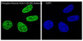 Immunofluorescent staining of human HeLa cells treated and untreated with H2O2 using phospho-Histone H2AX antibody (green) and DAPI nuclear stain (blue).