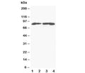 Western blot testing of MTA1 antibody and Lane 1: MCF-7; 2: HeLa; 3: Jurkat; 4: CEM cell lysate. Predicted molecular weight: ~81kDa.