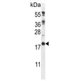 Western blot testing of mouse heart tissue lysate with Calcipressin-2 antibody. Predicted molecular weight ~22 kDa.