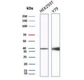 Western blot testing of human HEK293 and Y79 cell lysate with recombinant CKB antibody. Predicted molecular weight ~43 kDa.