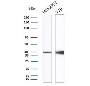 Western blot testing of human HEK293 and Y79 cell lysate with recombinant CKB antibody. Predicted molecular weight ~43 kDa.